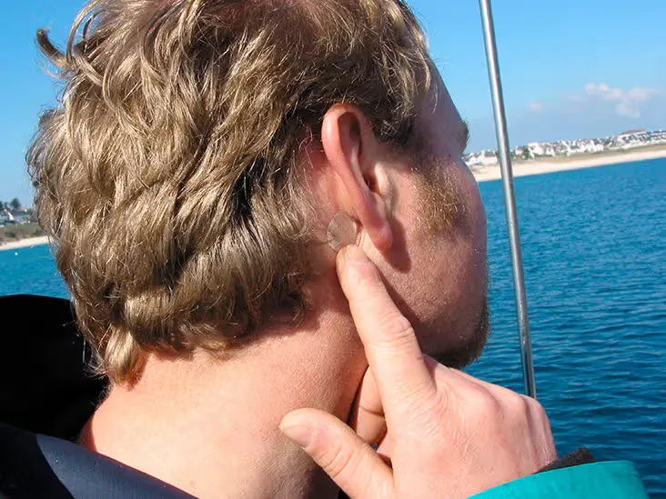 Patch contre le mal de mer posé derrière l'oreille
