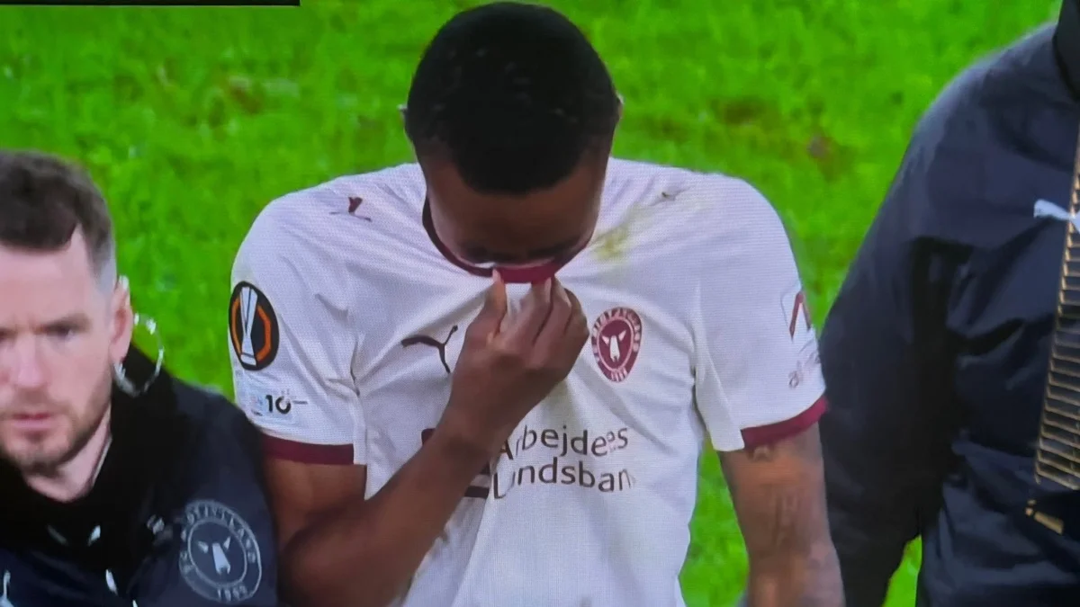 Denil Castillo sale lesionado entre lágrimas en el partido ante la AS Roma