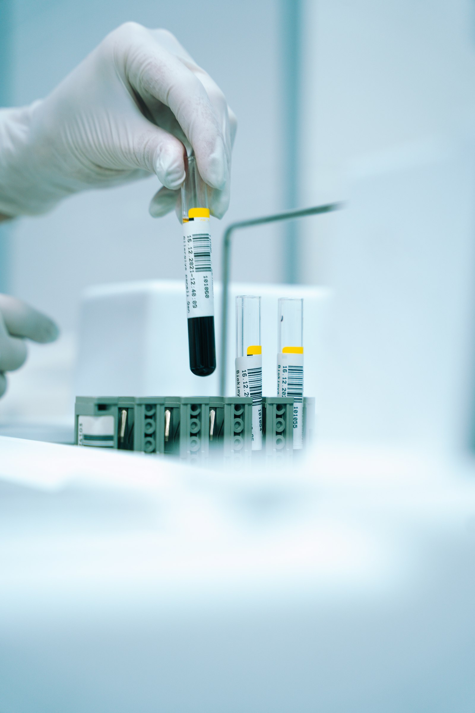 Gloved hand holding a labelled blood sample tube above a rack of tubes