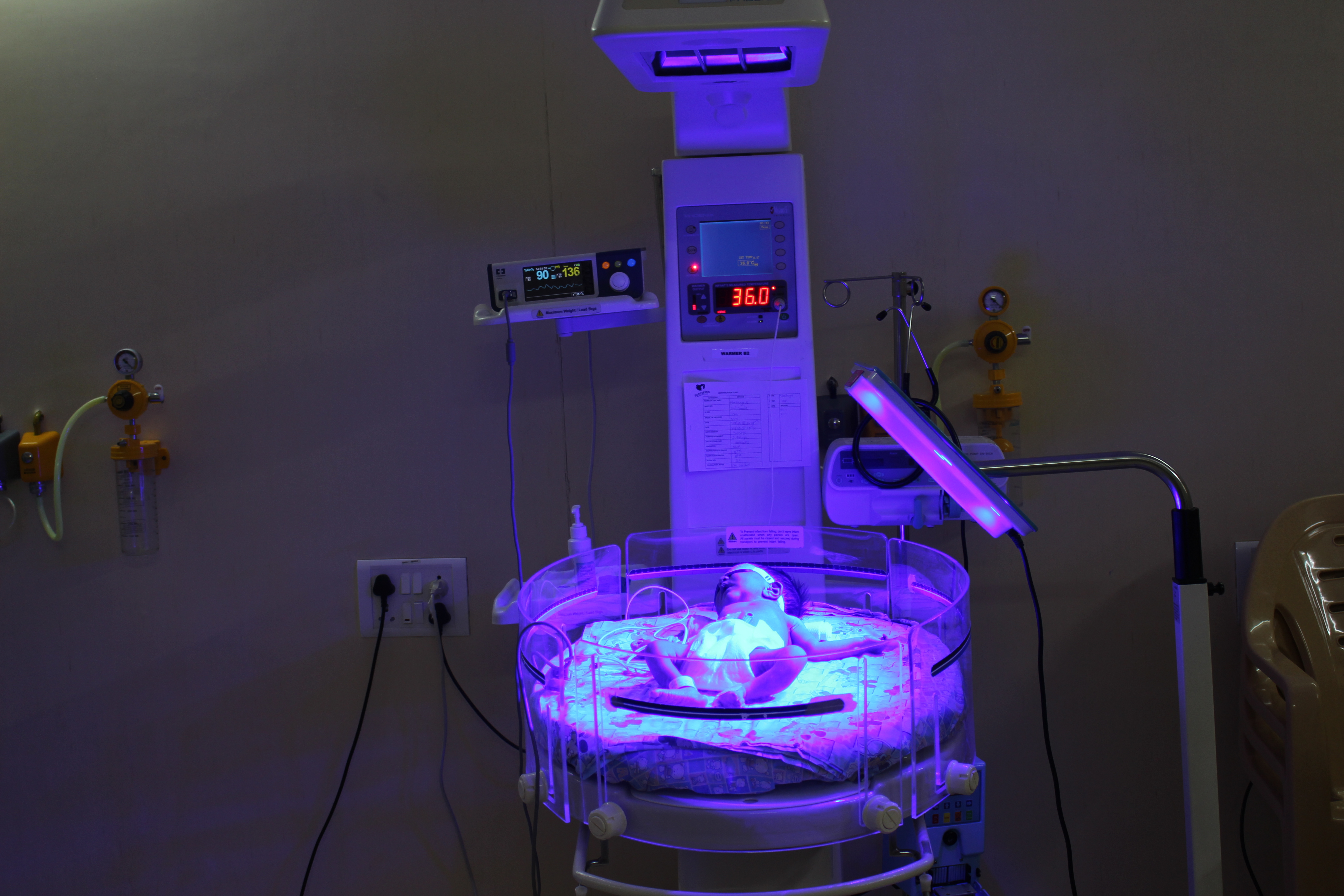 Infant Phototherapy 