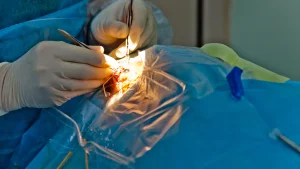 An illustrative image of an ophthalmologist examining a patient's eye during a post-cataract surgery follow-up appointment