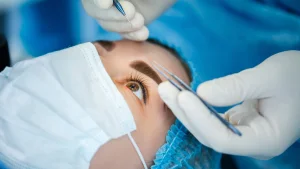 A close-up of laser eye surgery being performed — surgical instruments positioned near the patient's eye